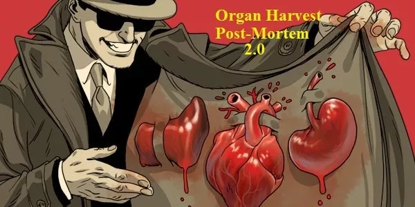 Harvest Organs Post Mortem