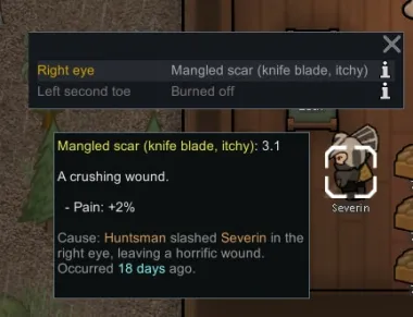Who shot my leg off?
