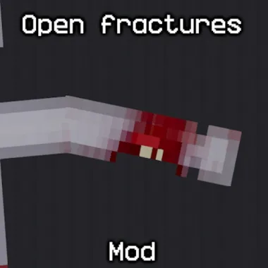 Open fractures mod